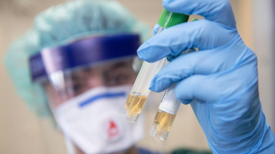 В Коми зарегистрировано еще 8 случаев заражения коронавирусом