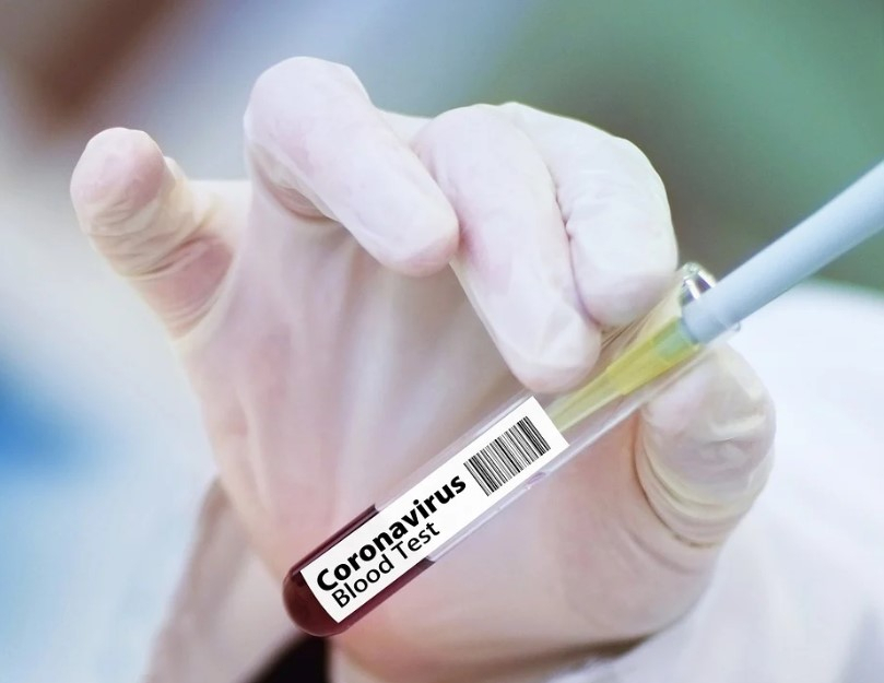 В Минздраве сообщили, когда вакцина от коронавируса прибудет в Коми