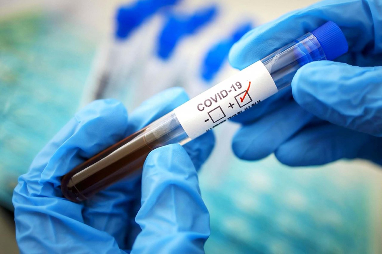 В России предложили возмещать затраты на тестирование на коронавирус